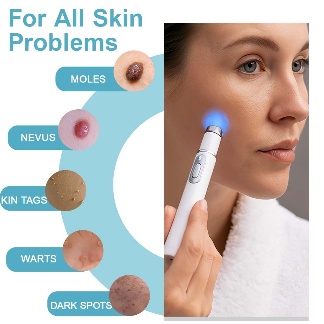 1 Pezzo Penna per Acne a luce Blu, Penna Talpa a Punto laser e Verruche, Per Eliminare l'acne, Per Viso e Corpo