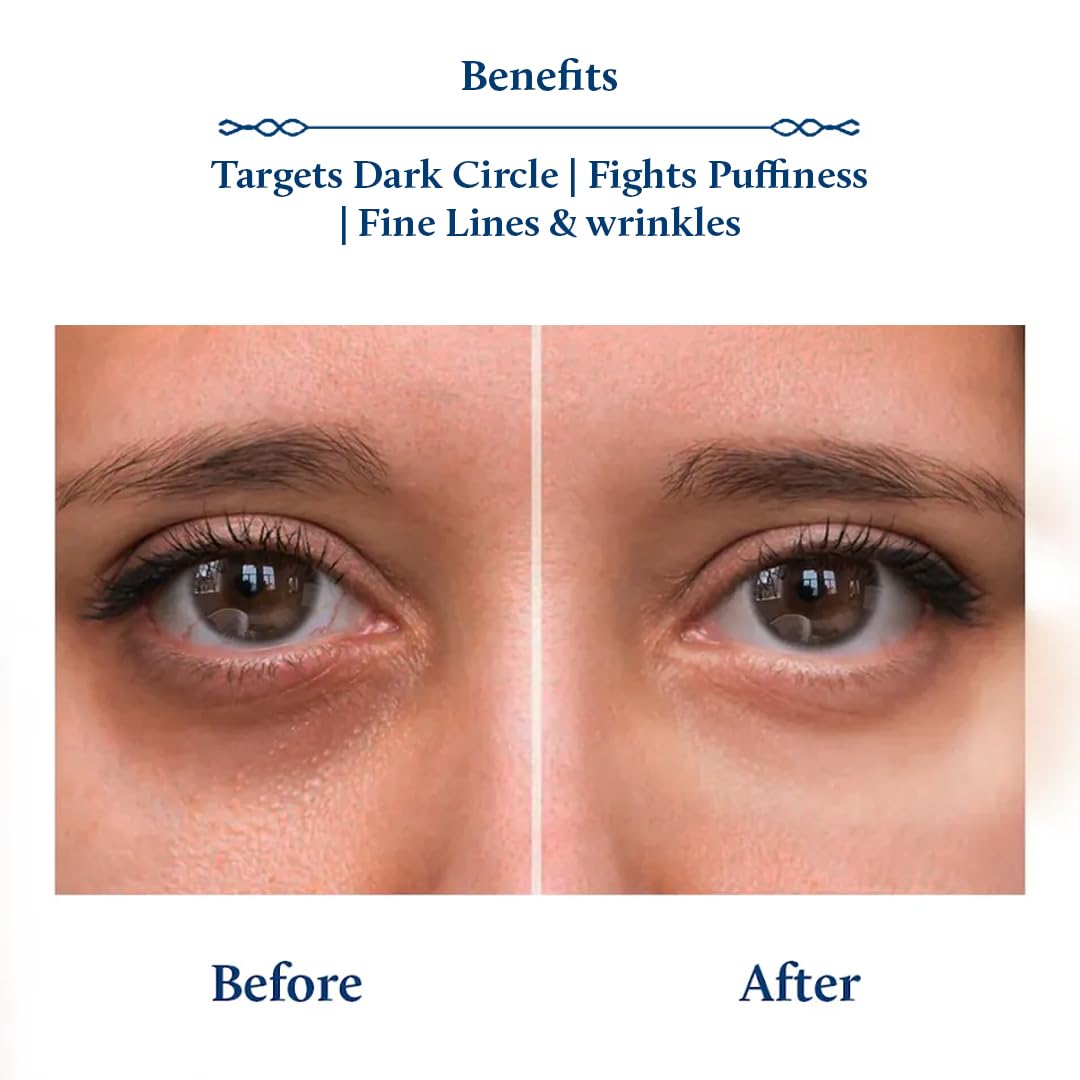 Blue Nectar Under Eye Cream for Dark Circles for Women, 15 g (Pack of 1) - Image 3