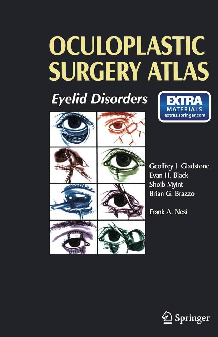 Amazon | Oculoplastic Surgery Atlas | Nesi, Frank A. | Plastic