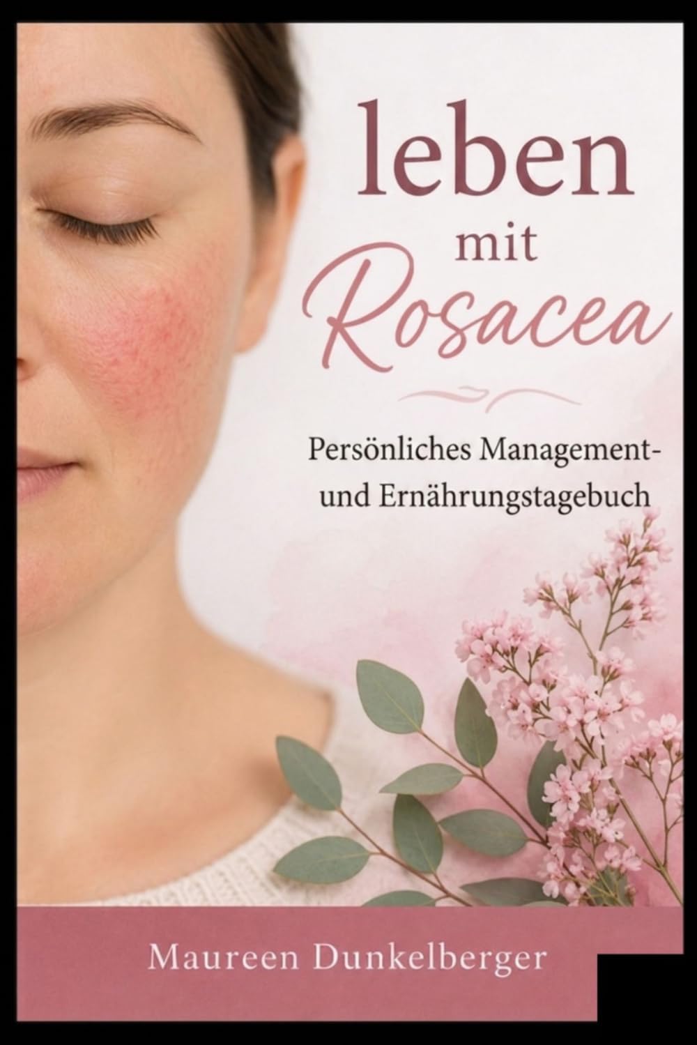 Leben mit Rosacea: Persönliches Management und Ernährungstagebuch