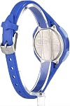 Timex Women's Ironman Essential 34mm Watch