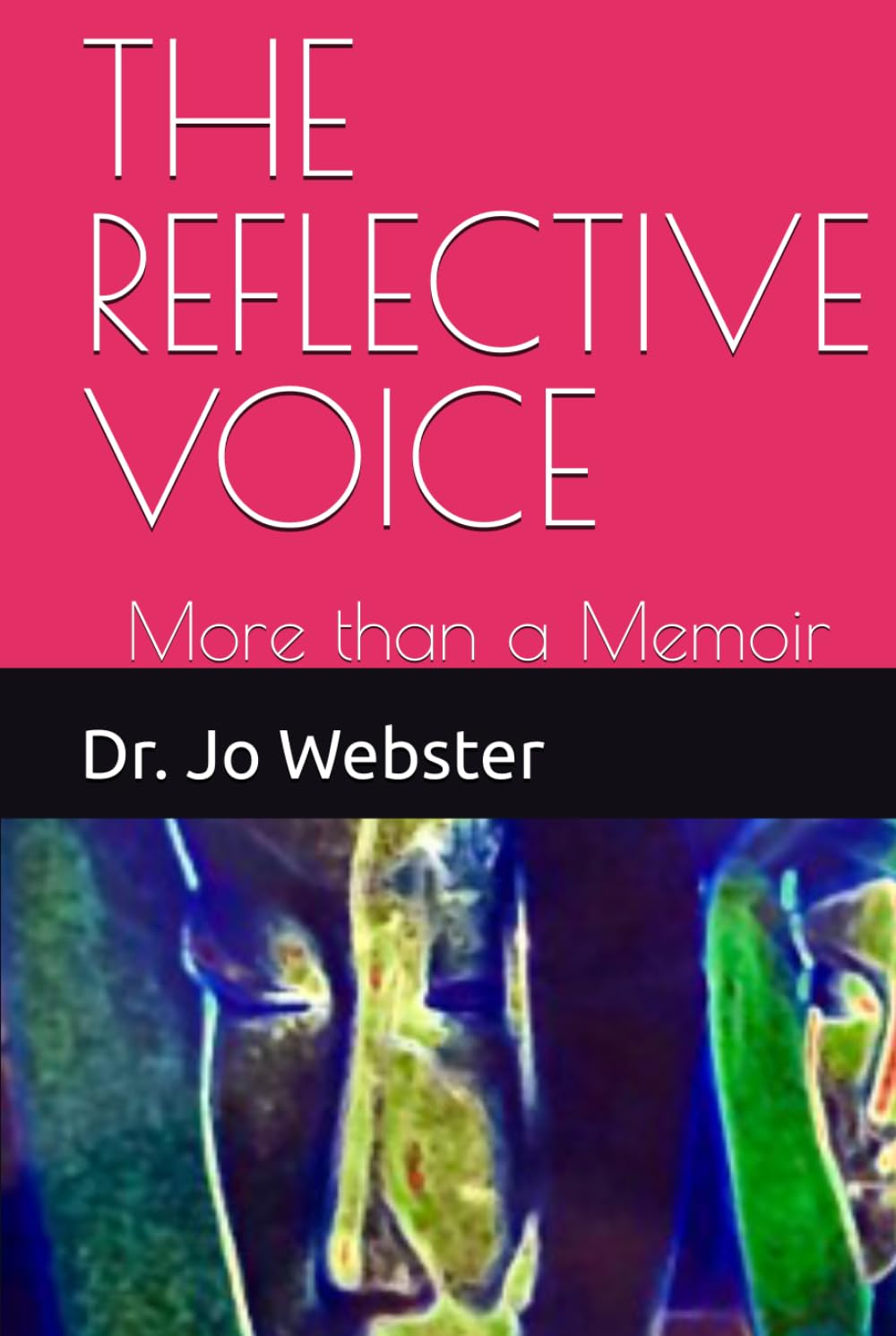 THE REFLECTIVE VOICE: More than a Memoir