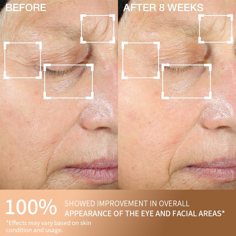QINGLIN Ensemble crème pour le visage et les yeux - Crème raffermissante anti-rides polypeptide