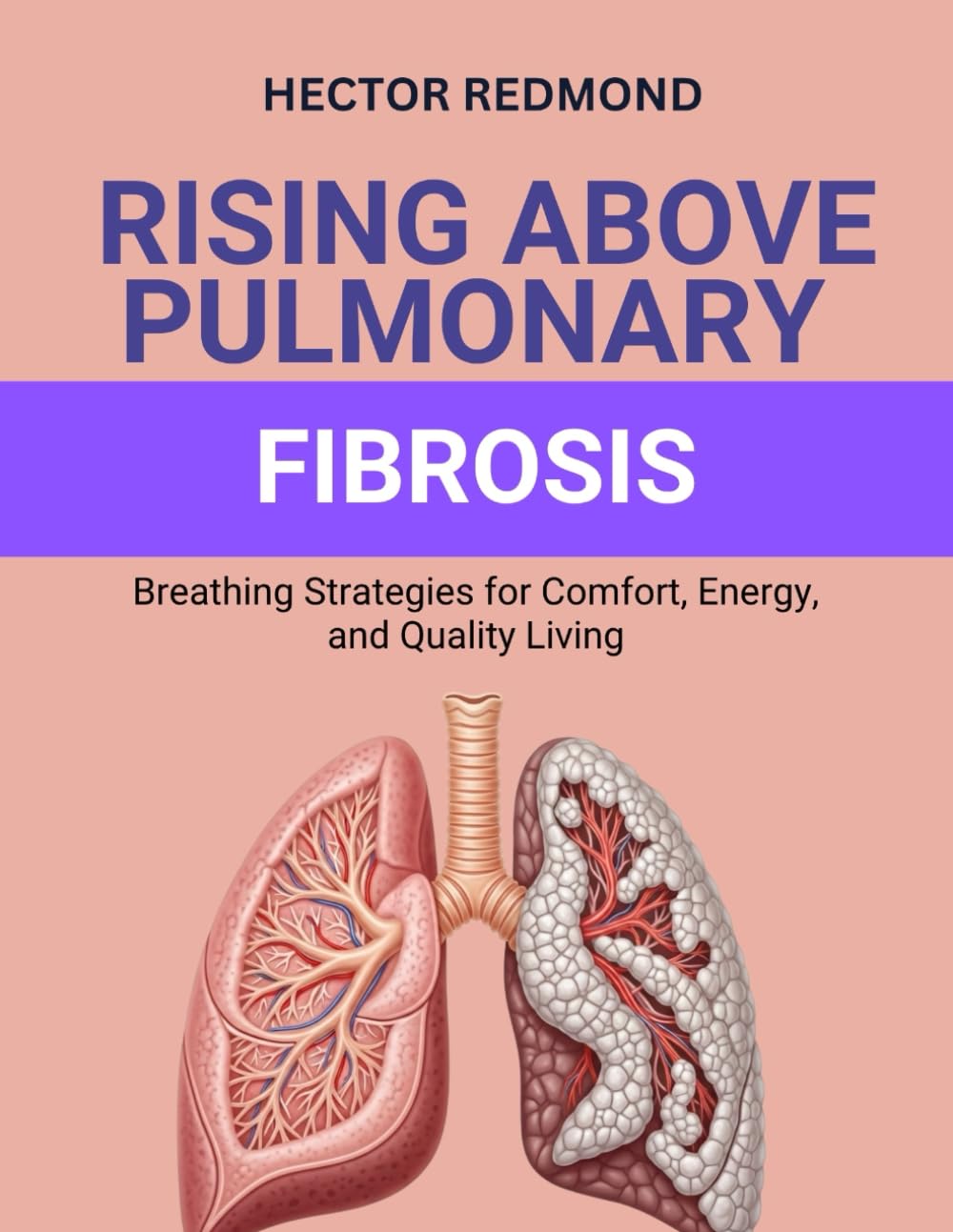 Rising Above Pulmonary Fibrosis: Breathing Strategies for Comfort, Energy, and Quality Living