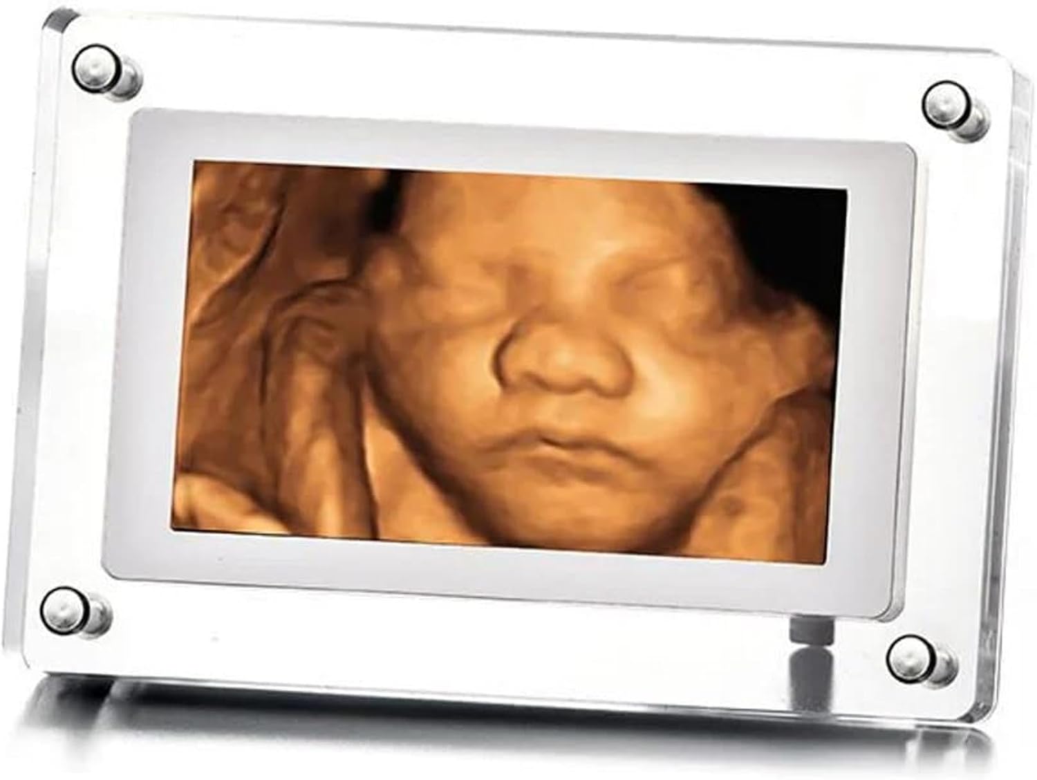 MBHB Digital Picture Frame, 7” Screen, Electronic Photo Frames for Ultrasound Replay, Re-chargeable 4GB Memory, USB Charging, Vertical/Horizontal Display, Upload Photos/Videos Easily