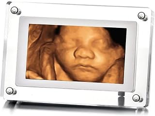 MBHB Digital Picture Frame, 7” Screen, Electronic Photo Frames for Ultrasound Replay, Re-chargeable 4GB Memory, USB Charging, Vertical/Horizontal Display, Upload Photos/Videos Easily