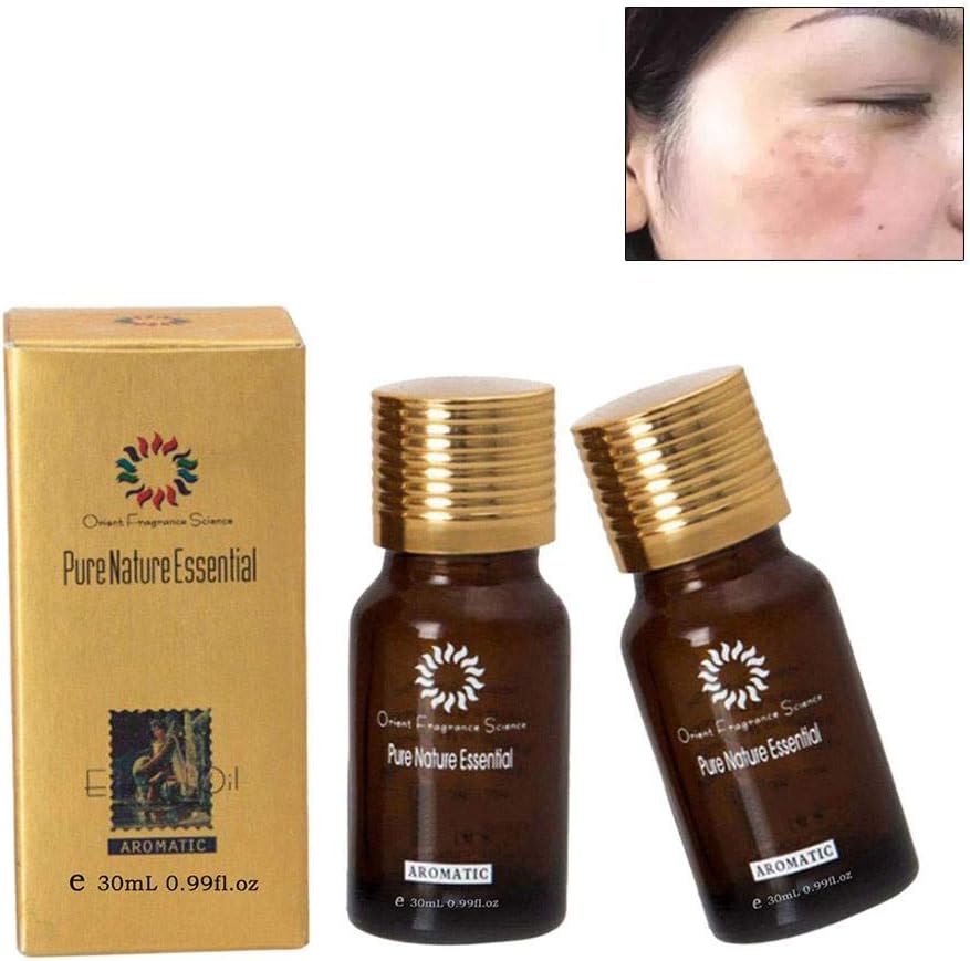 2 PCS Ultra Brightening Spotless Oil Remove Dark Spots Essential Oil Age Spots Natural Pure Removal Hyper-Pigmentation Body Oil Skin Care Essential Oil
