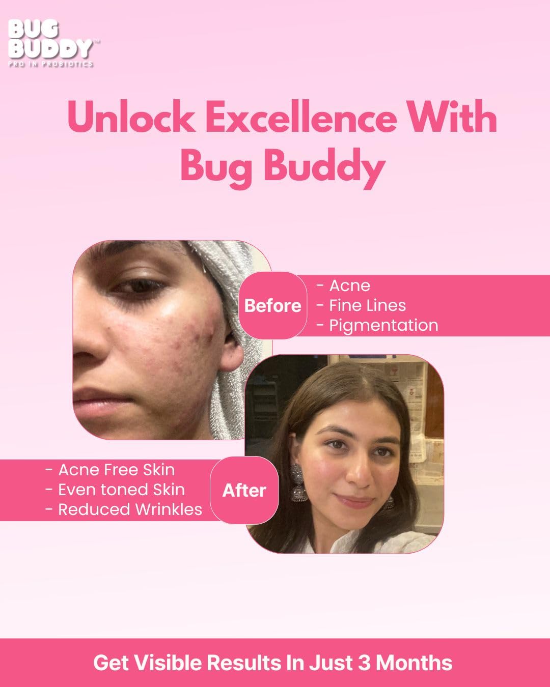 Bug Buddy - Time To Shine | Glutathione for Skin Whitening with Collagen & Probiotics (5 Bn CFU) | Backed by 13+ Clinical Studies | For Glowing Skin, Acne reduction & Healthy Hair | 15 Days Pack 2