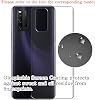 Película protectora trasera, pack de 2, compatible con ZTE Axon 7 mini Axon7 mini, funda TPU de protección (no vidrio templado/no protector de pantalla frontal) 7