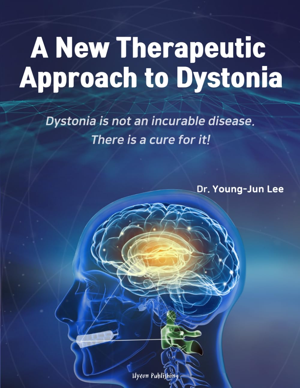 A New Therapeutic Approach to Dystonia: Dystonia is not an incurable disease. There is a cure for it.