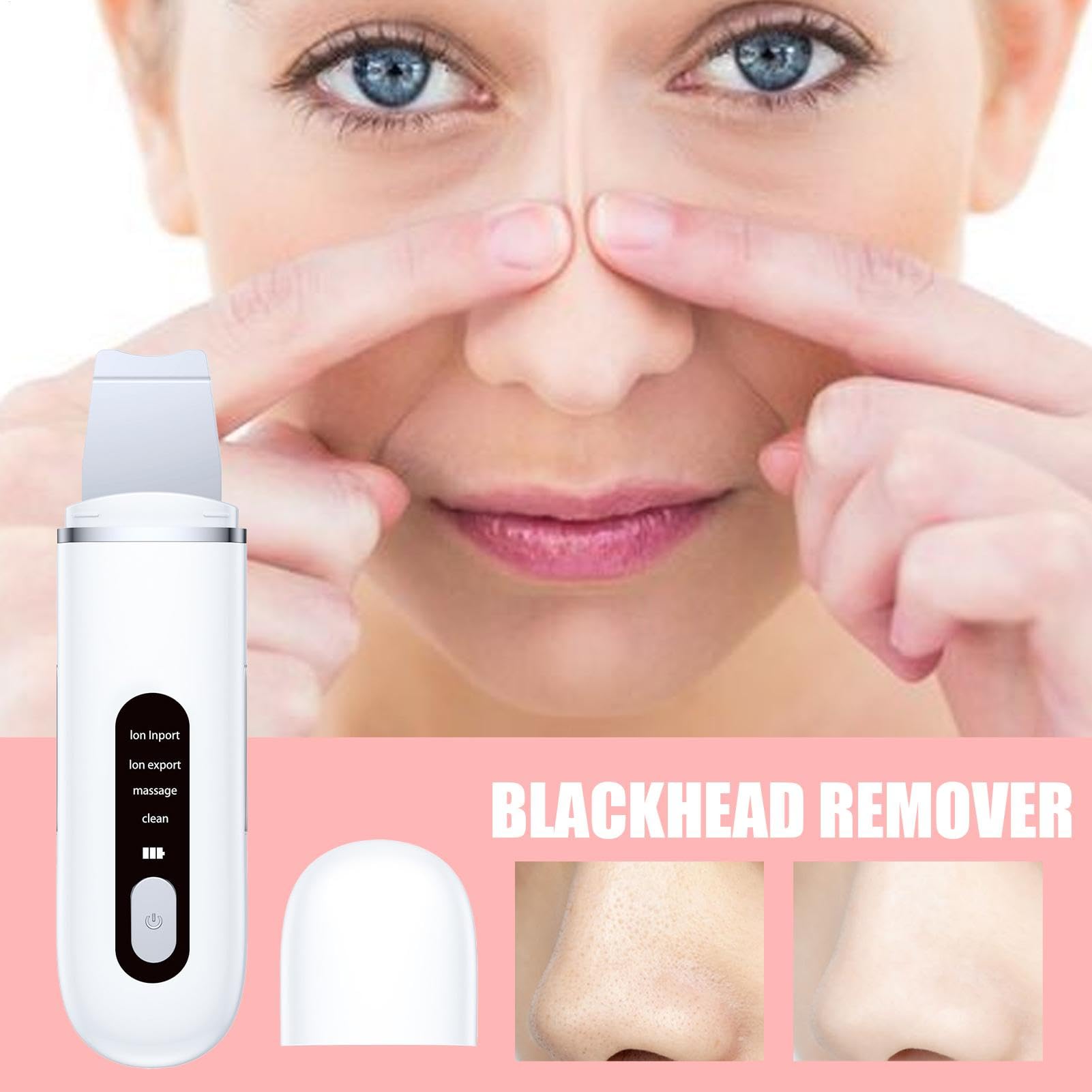 Épurateur de peau ultrasonique, épurateur pores - Spatule de peau ultrasonique portable | de pores faciaux, instrument de beauté, dissolvant de point noir, outil de nettoyant de pores pour re