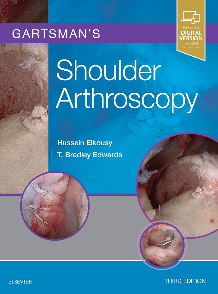 Gartsman's Shoulder Arthroscopy