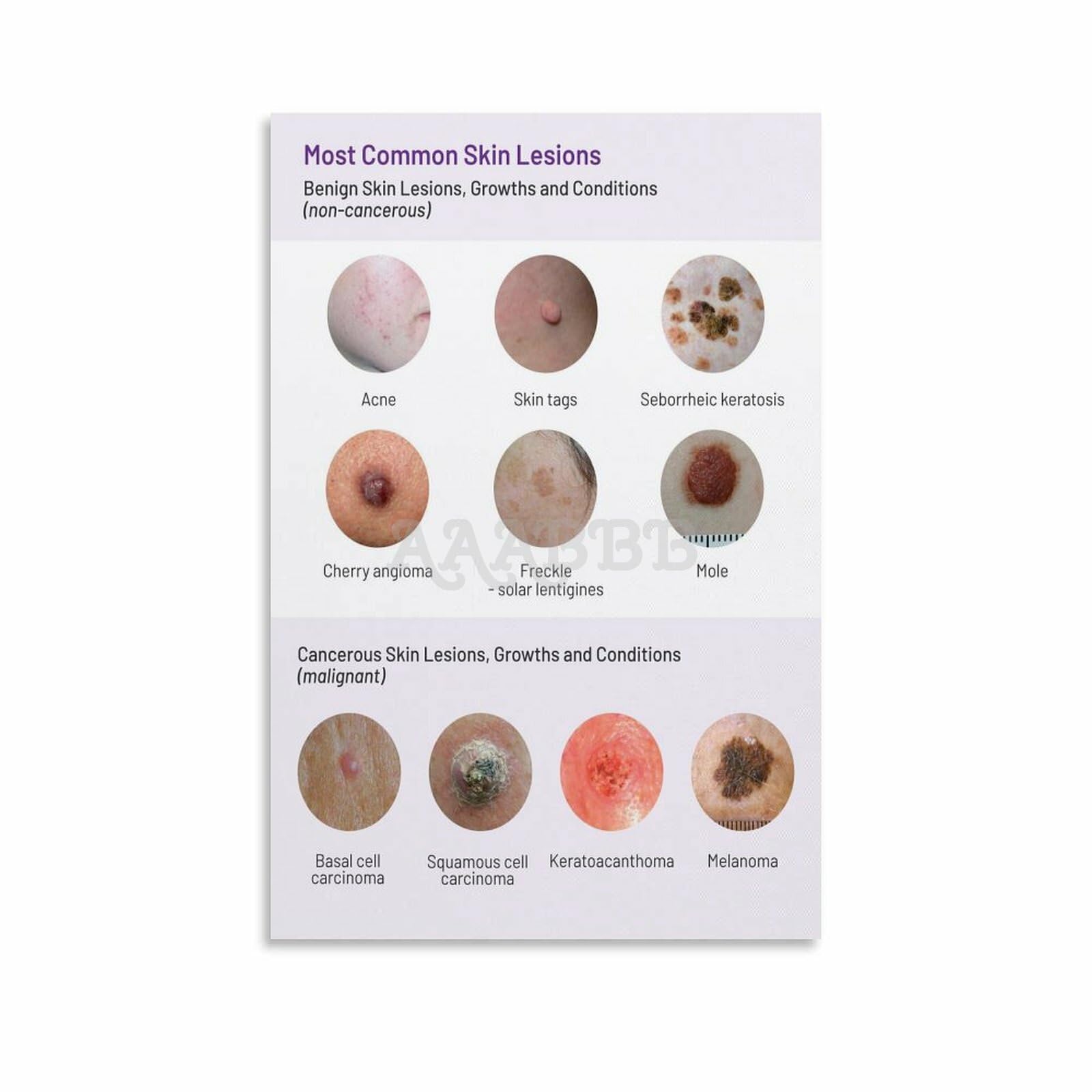 skin-lesions-types-with-pictures