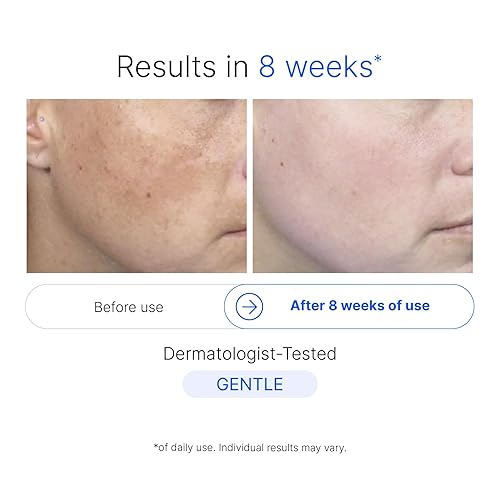 Miniatura 5 de Ariege - Suero corrector de manchas oscuras – Eliminador de manchas oscuras no irritante para cara con ácido hialurónico – Suero corrector de