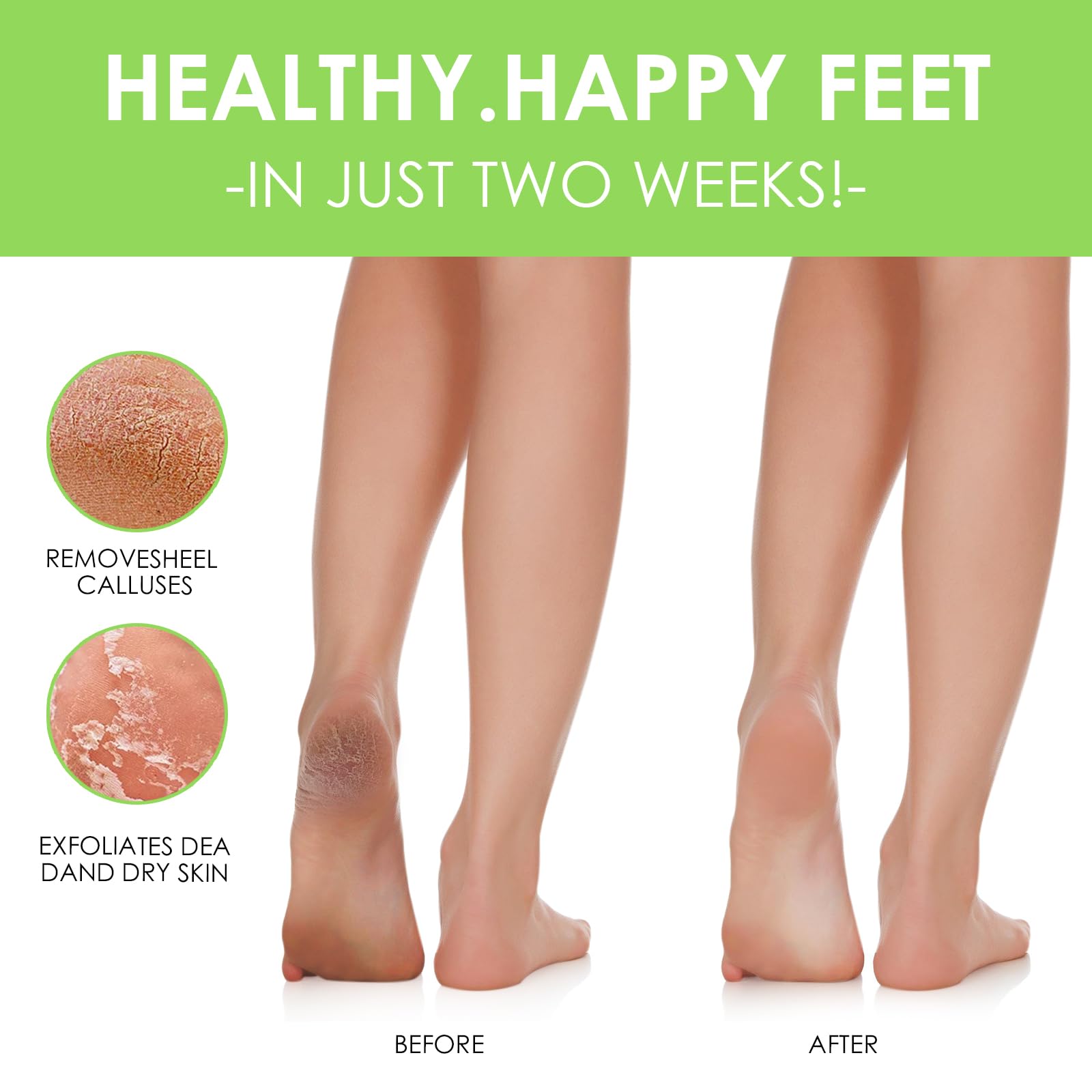 2 Paires Masque Pied, Masque Peeling Pieds et Nourrissant, Beauté pour Pied Secs et fendillés, Pieds Doux, Füße, Pour Femmes Hommes(Aloe Vera)