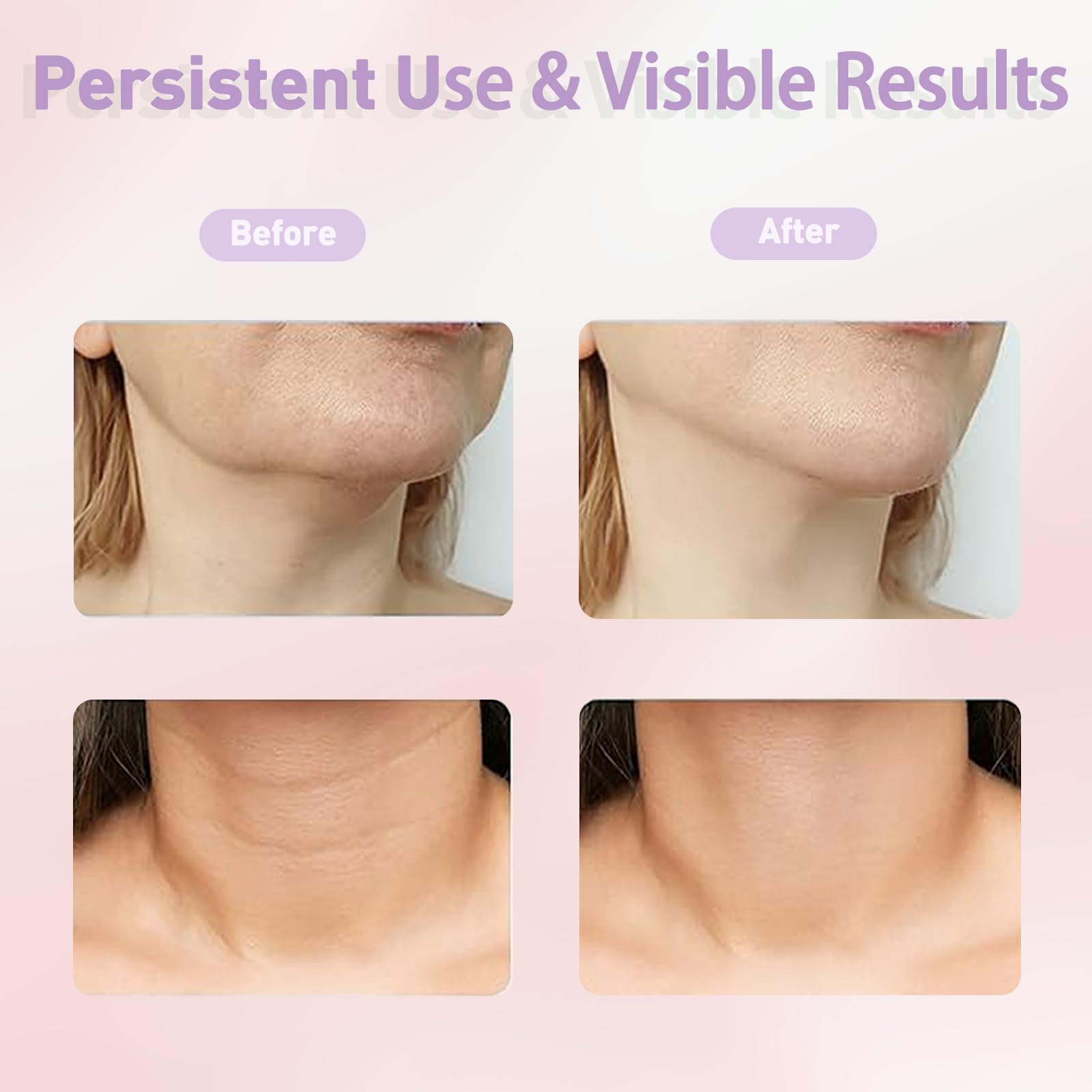 Masajeador de cuello y cara, masajeador facial multifuncional LED de 7 colores, blanco - herramienta para esculpir la cara 6