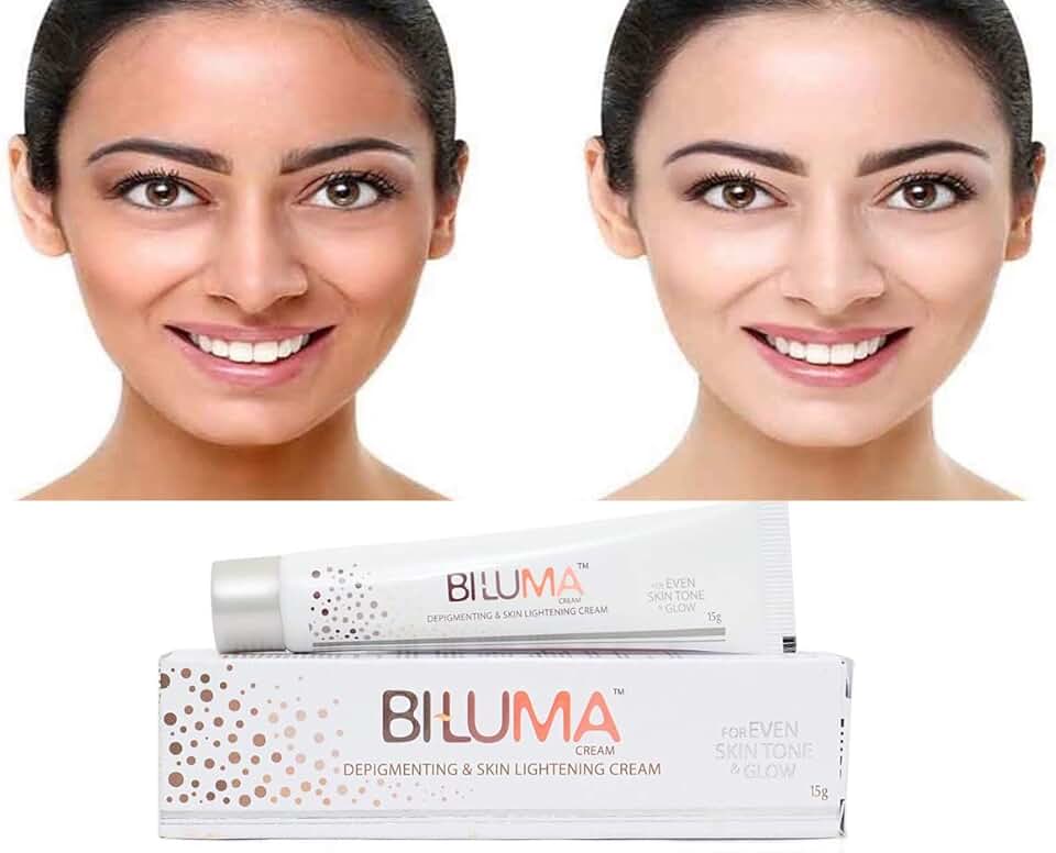 Amazon.co.uk cream melasma