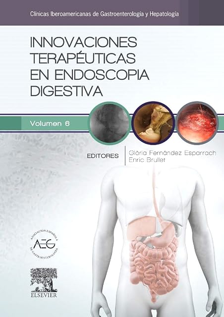 Portada de Innovaciones terapéuticas en endoscopia digestiva