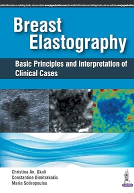 BREAST ELASTOGRAPHY BASIC PRINCIPLES AND INTERPRETATION OF CLINICAL CASES