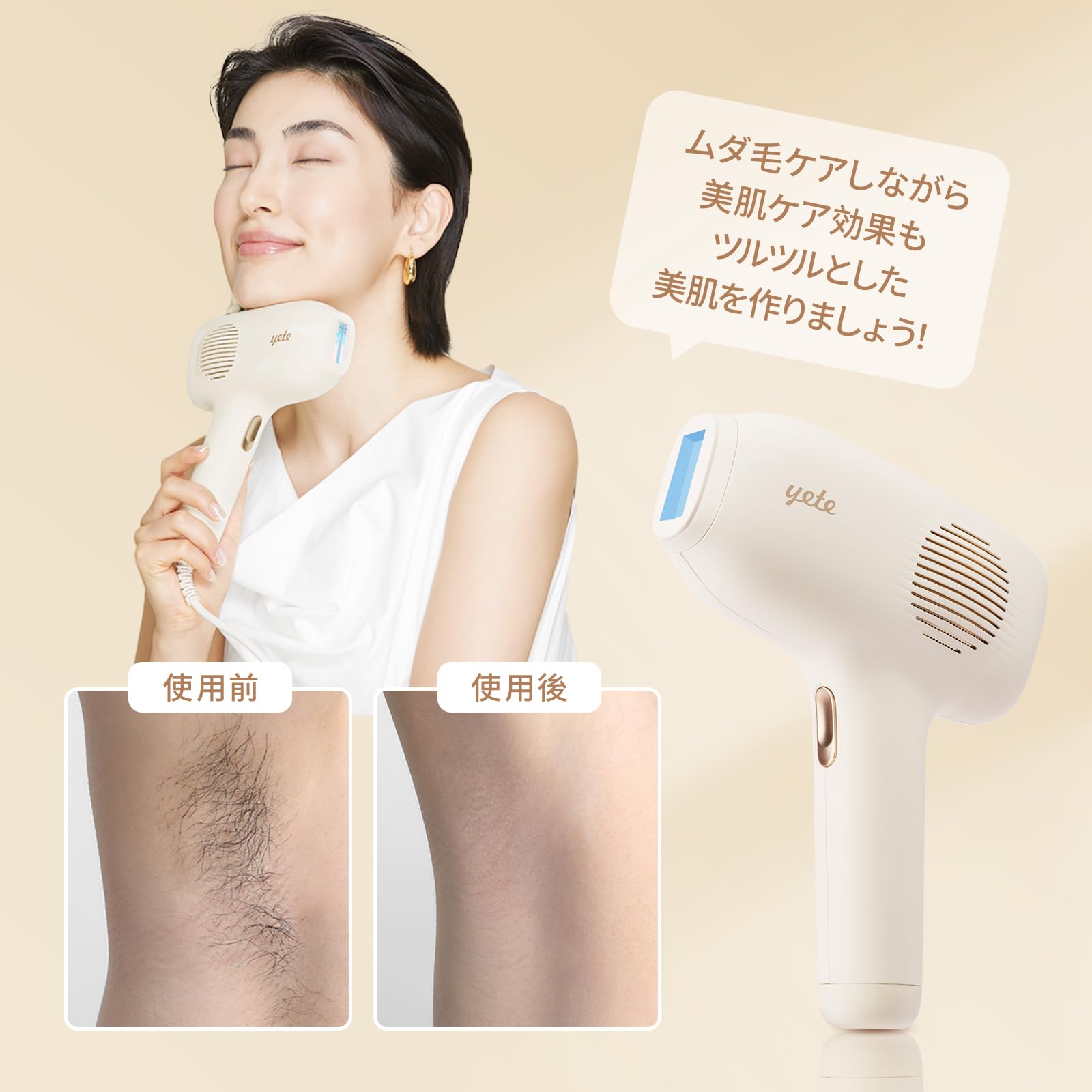 YETE 冷感脱毛器 全身VIO対応 フラッシュ脱毛