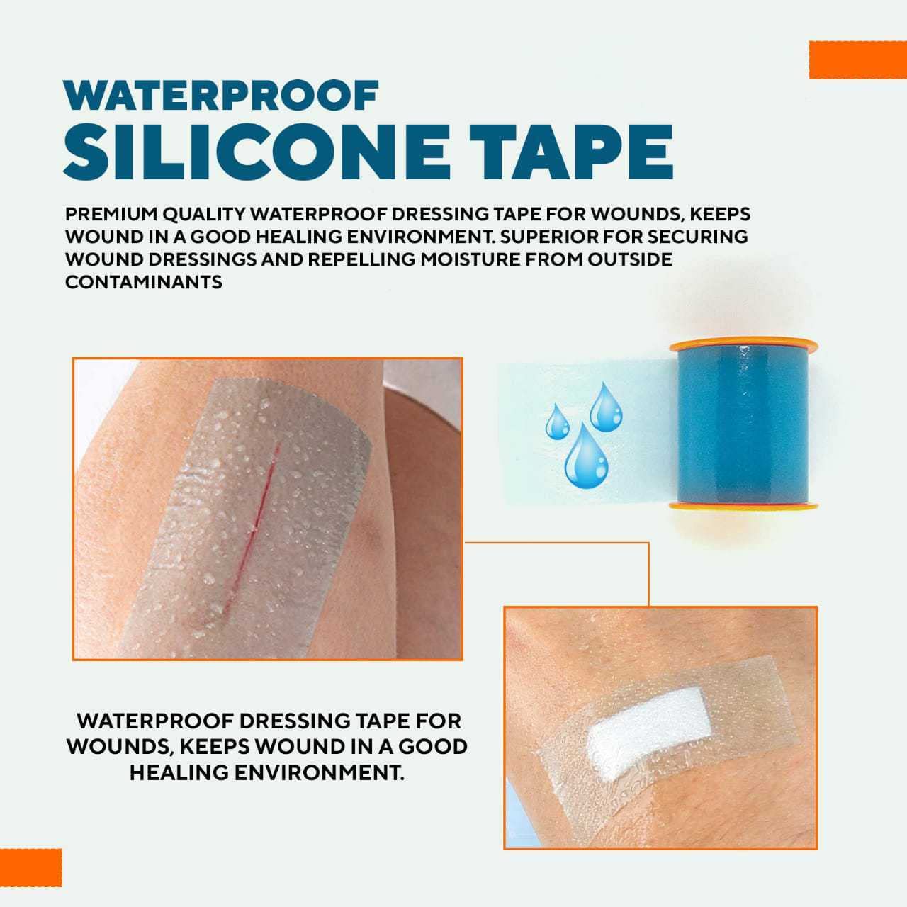 Safe n' Simple Simpurity DermaPro Waterproof Silicone Tape for Securing Wound Dressing, Waterproof First Aid Tape, Soft & Comfortable, Easily Removable Tape, 2" x 15'', Box of 6, (SNS57232) : Industrial & Scientific