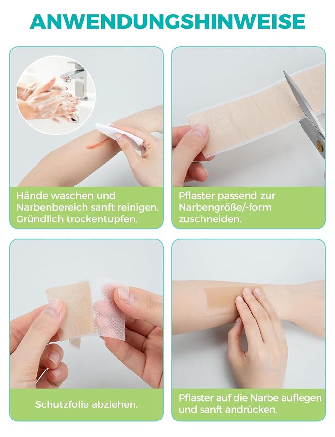 Silikon Narbenpflaster 150 cm wiederverwendbar für Kaiserschnittnarben | Medizinisches Silicone Scar Sheets für Keloid, hautverträglich, atmungsaktiv, wasserdicht, Bild 5