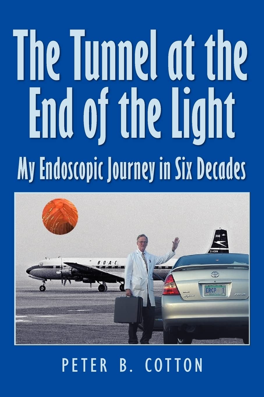 The Tunnel at the End of the Light: My Endoscopic Journey in Six Decades