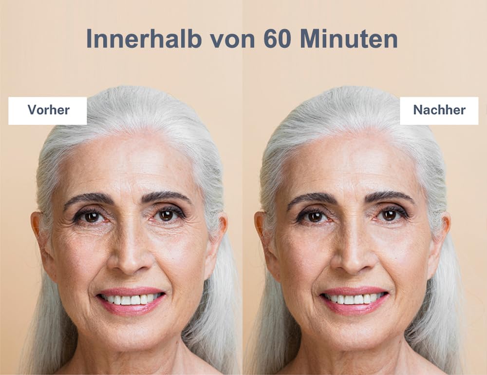 DermaAktiv Feuchtigkeits-Booster Anti-Aging Ampullen, 10 Stück