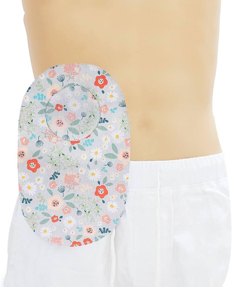 Share more than 147 stoma bag smell best xkldase.edu.vn