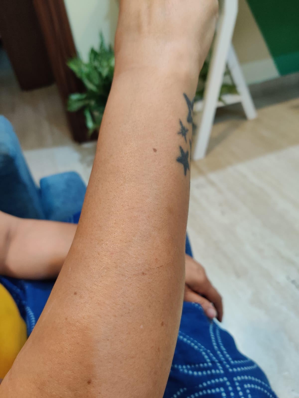 ERIKKA INDIA Ipl Hair Removal Handset, Advanced Diy Ipl Laser For Men