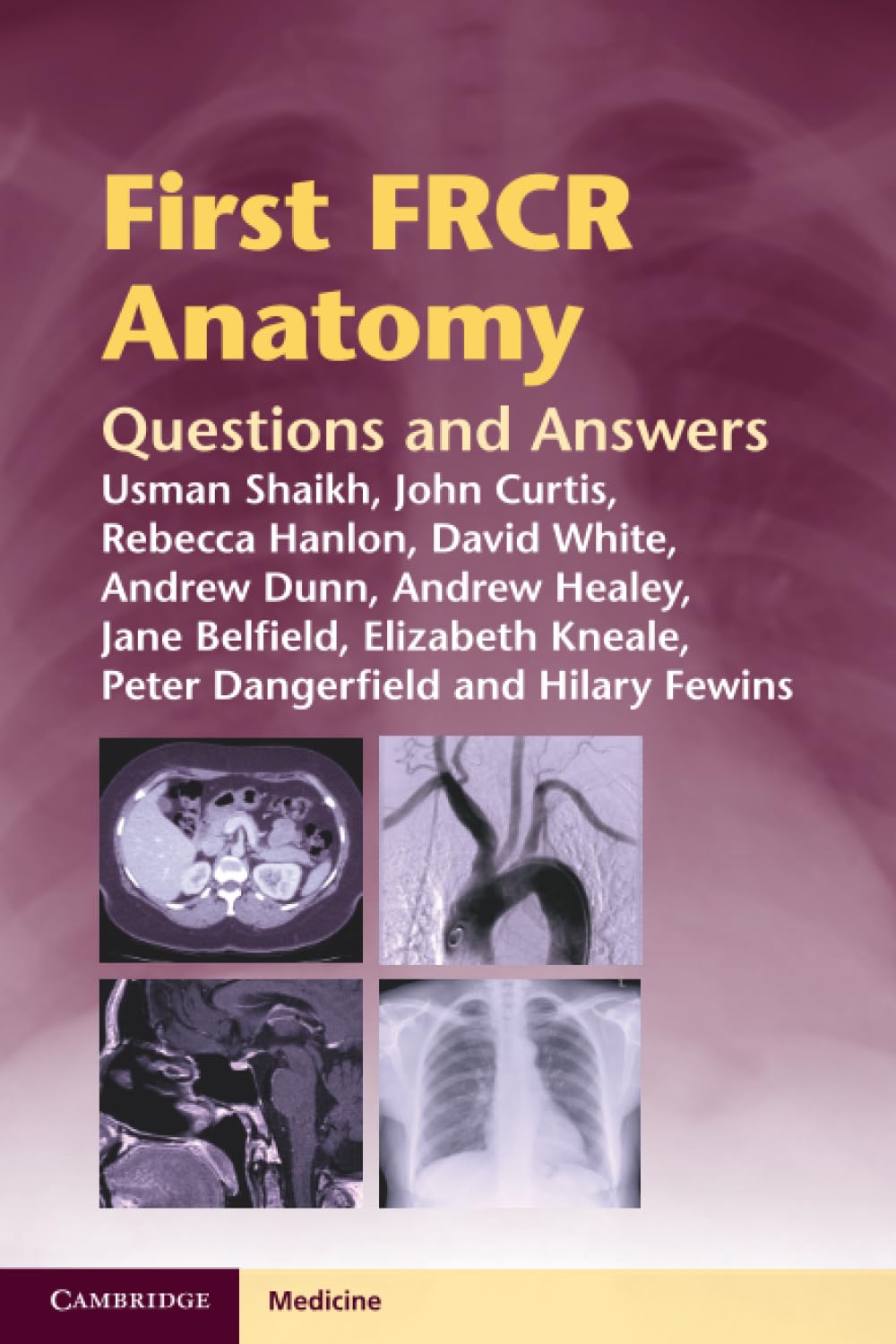 First FRCR Anatomy: Questions and Answers (Cambridge Medicine (Paperback))