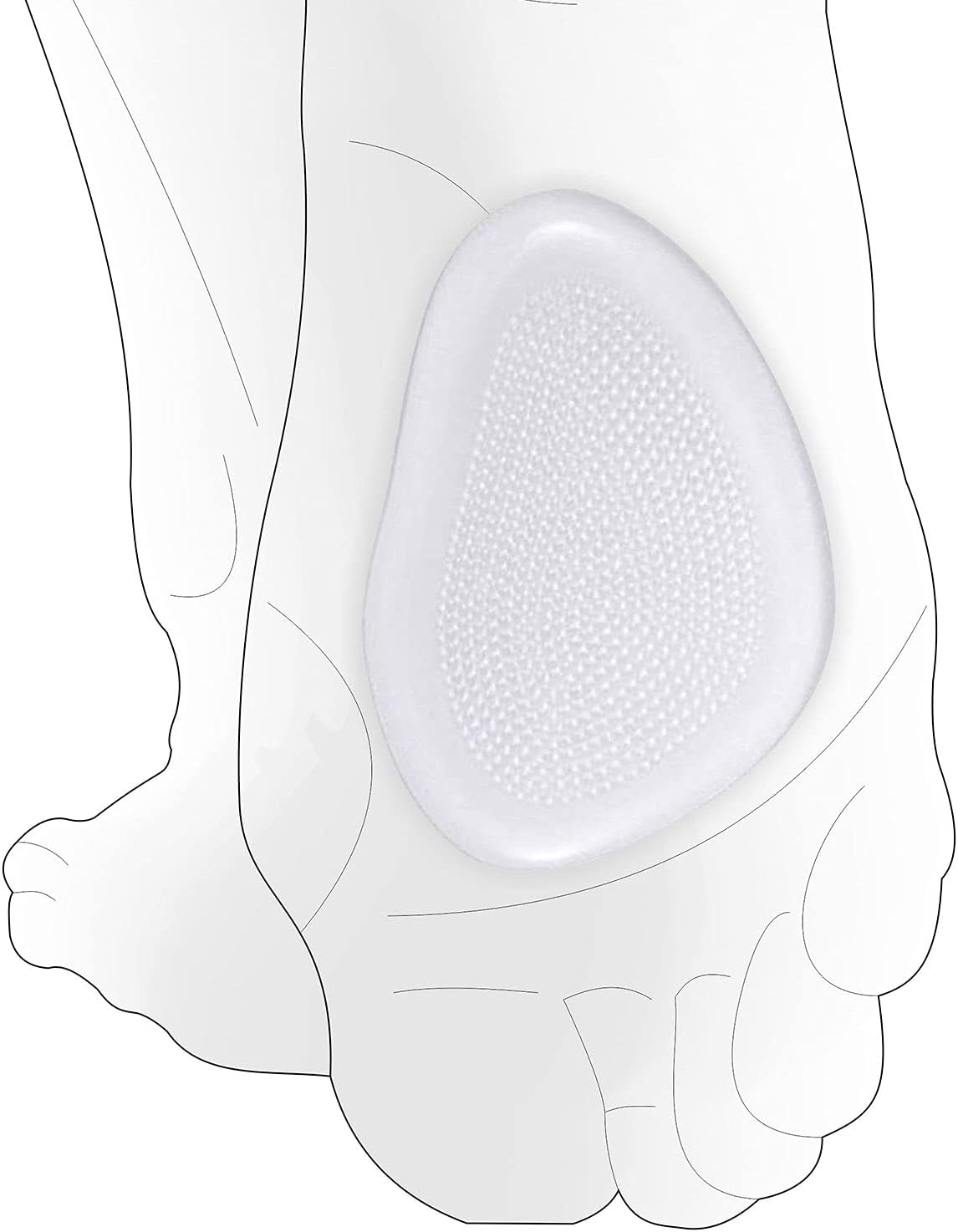 PEDIMENDMetatarsal Pad - 4 Pieces | Mortons Neuroma Support | High Heel Comfort Insoles for Pain | Ball of Foot Soft Cushion | Shoe Inserts | Metatarsalgia Gel Pads for Feet | Non Slip Sticky