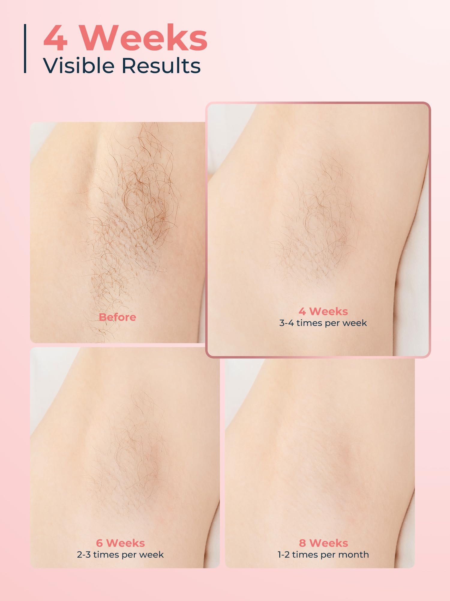 Épilateur Lumière Pulsée avec Système de Refroidissement, Écran Tactile LCD, 9 Niveaux et Lumière Rouge 600 nm, 999900 Flashs, Épilation Laser pour Femmes, Visage, Bras, Maillot, Corps, Rose - 3