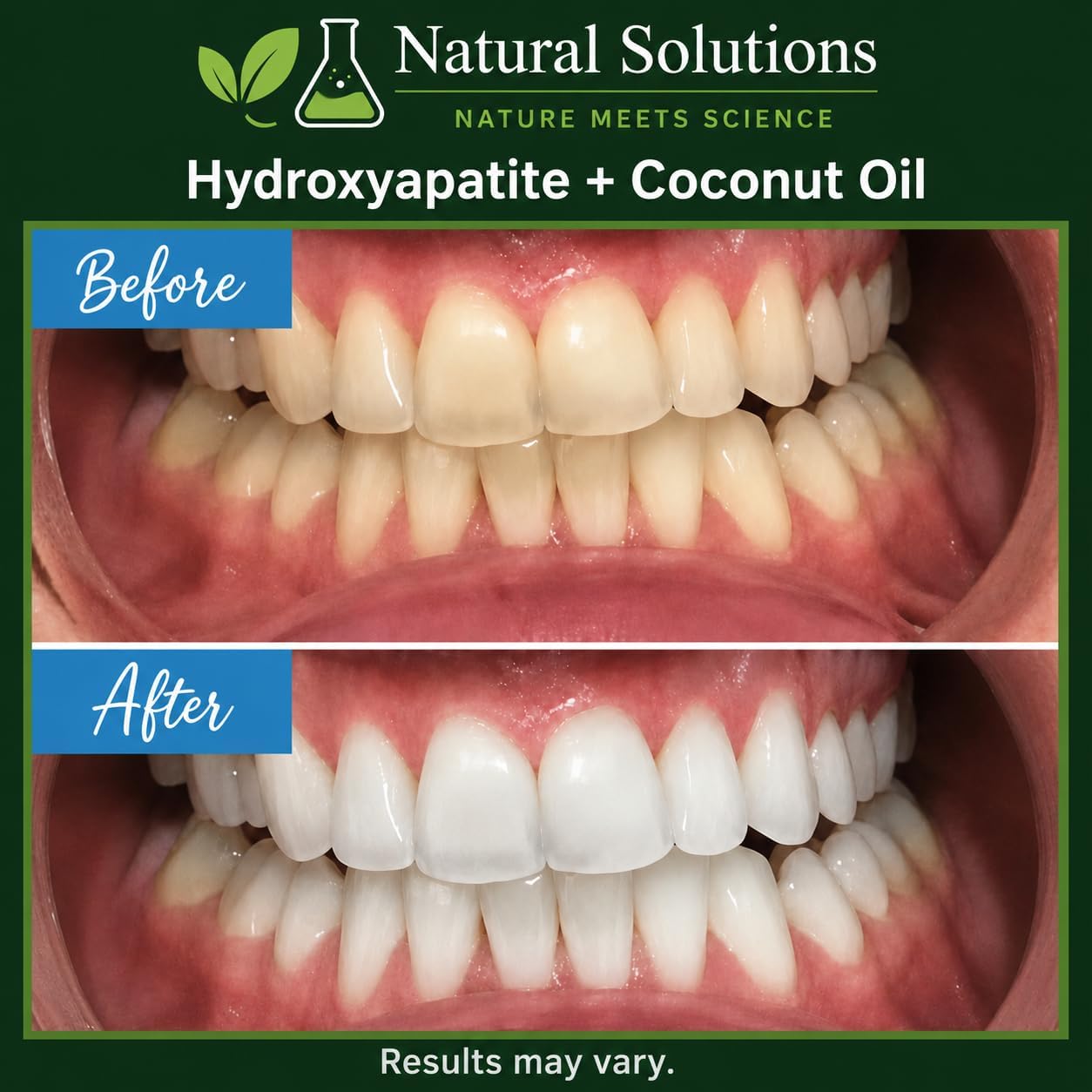Powerful Whitening Hydroxyapatite & Coconut Oil Toothpaste – Fresh Mint Flavor – Enamel Protection for Sensitive Teeth – Natural Solutions N.M.S. image 3