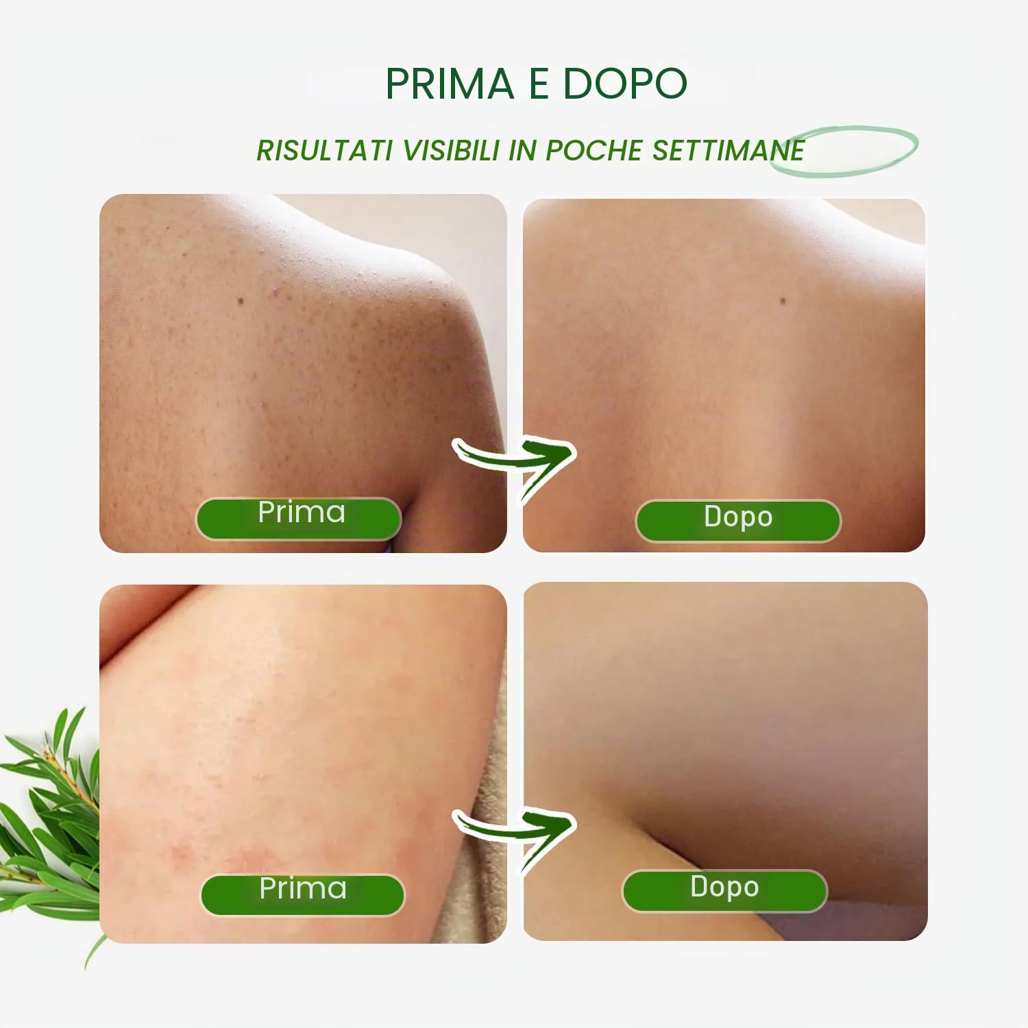 Tea Tree Body Wash, Gel Doccia Rinfrescante con Aloe, Olio di Cocco e Olio di Oliva, Uomo e Donna