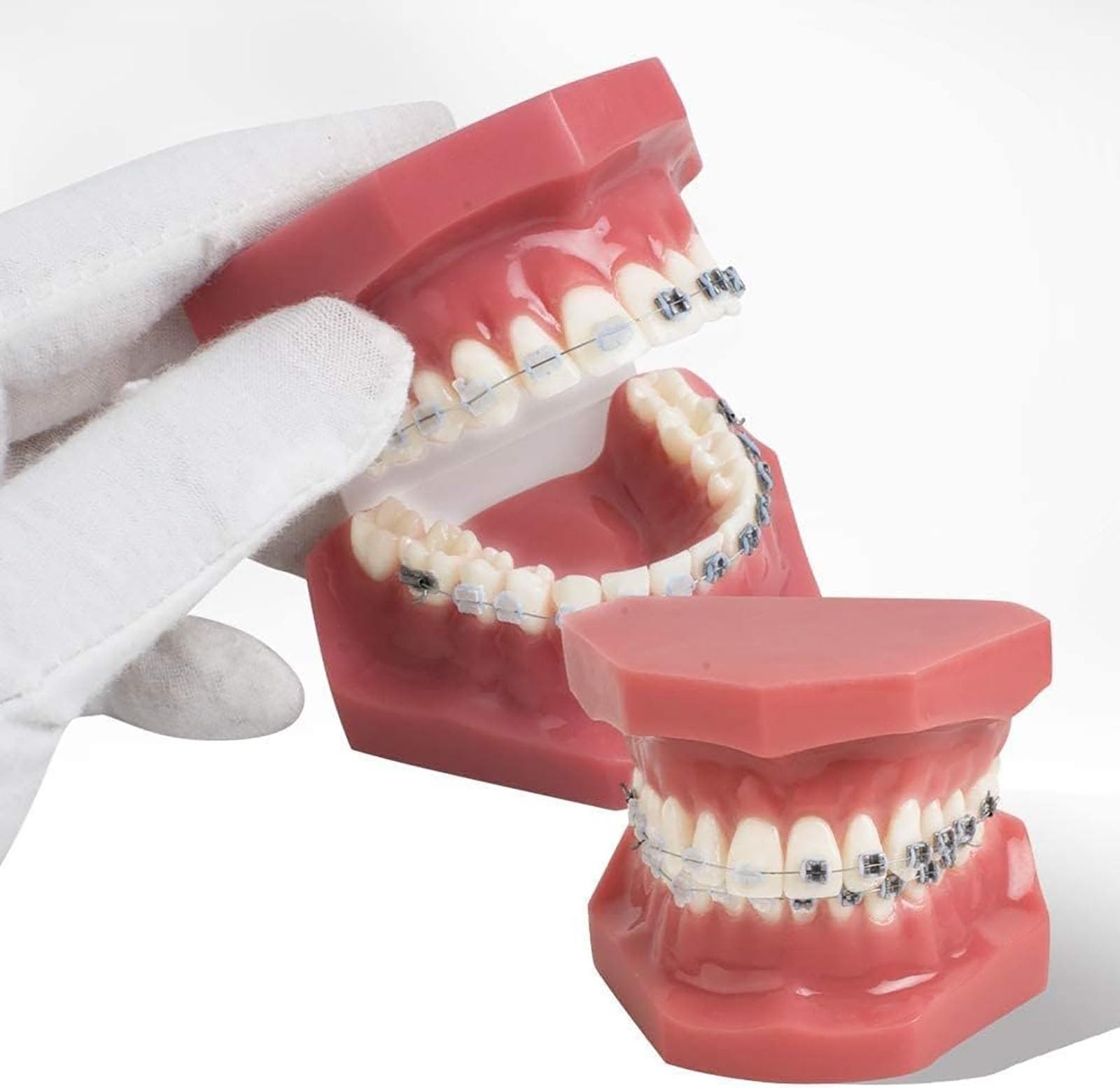 Zahnärztliches kieferorthopädisches Modell, Zahnmodell mit Metall- und Keramikklammern, orale Demonstrationsmodelle for den zahnärztlichen Unterricht oder die Kommunikation mit dem Zahnarzt.