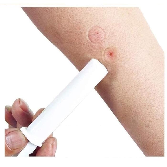 Buy FINEVER 2PK Mosquito Bee Sting Kit Suction Tool Safety First Aid