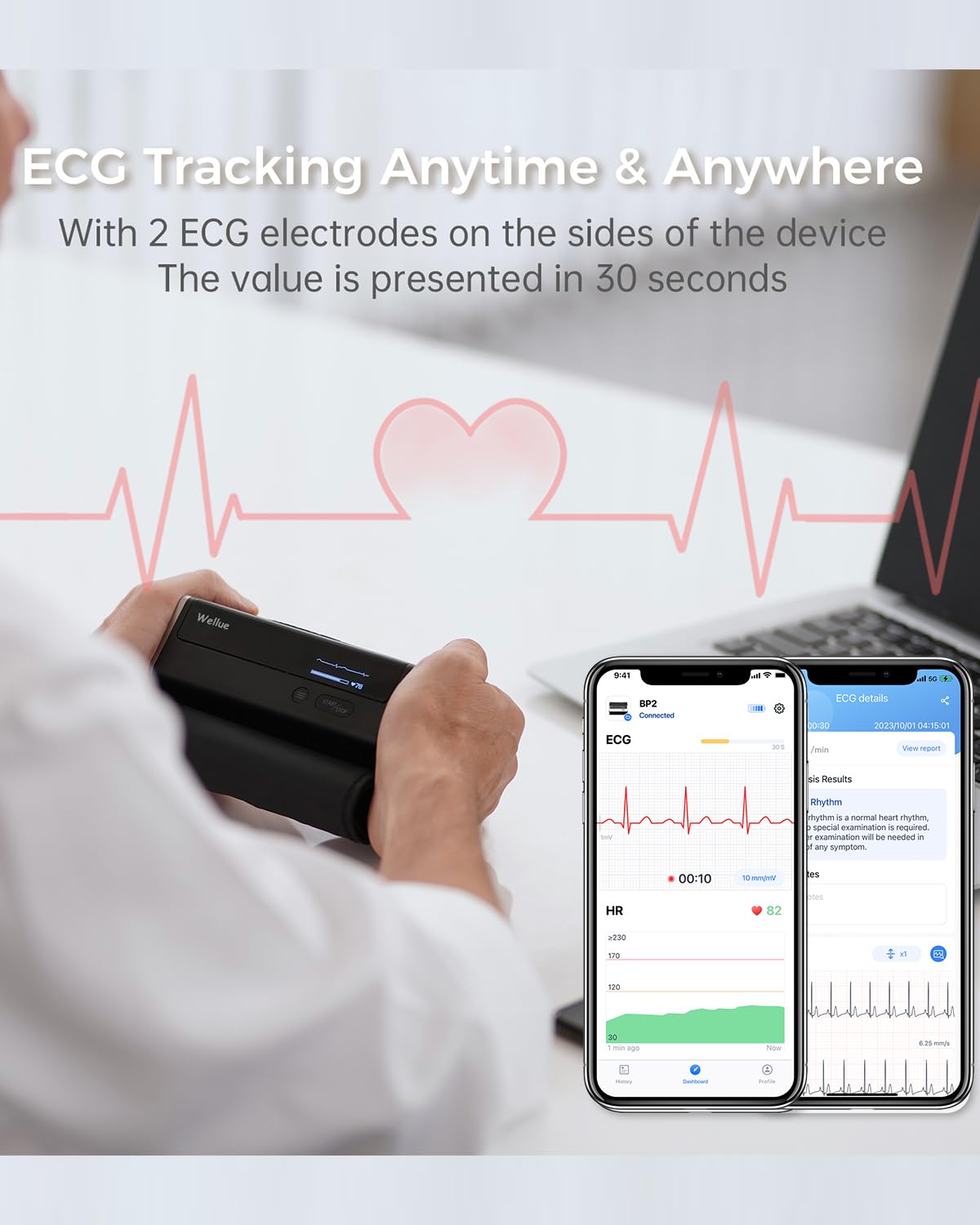 Wellue BP2 Connect -Tensiómetro de Brazo con ECG, Sincronización Wi-Fi y Bluetooth, Monitor de Presión Arterial, Monitoreo Cardíaco ECG, Mediciones en Tiempo Real