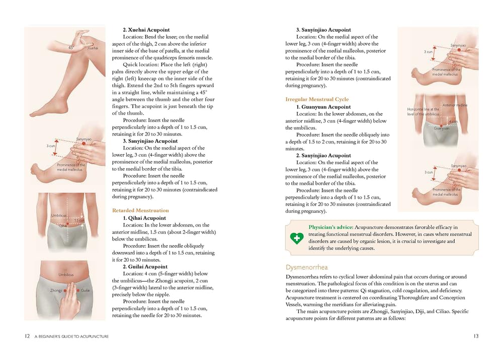 A Beginner’s Guide to Acupuncture: Treating Common Ailments through Traditional Chinese Medicine