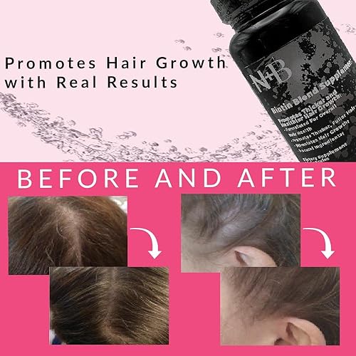 Miniatura 5 de Nicole + Brizee N+B Vitaminas para el crecimiento del cabello, con biotina, vitamina C, zinc y vitamina B12, fórmula para el cuidado del cabello a