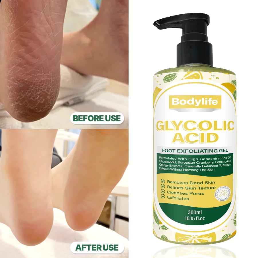 Glycolic Acid Foot Exfoliating Gel 10.15 fl oz Foot Peeling Gel Callus Remover Dead Skin Remover for Feet with Fruit Acids Lemon Lime Bilberry Hydrating Foot Peel for Smooth Soft Feet
