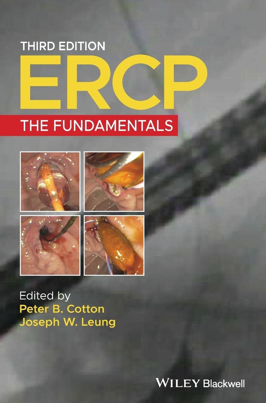 ERCP – The Fundamentals 3e Cotton Hardback Wiley–Blackwell 9781119601098