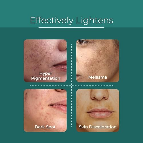 Miniatura 3 de Pure & Cimple Suero iluminador de piel probiótico | Tratamiento facial de manchas oscuras | Manchas de la edad | Melasma, daño solar y removedor de