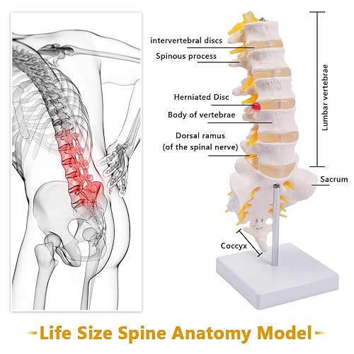 Miniatura 5 de breesky Modelo de columna lumbar - Modelo de anatomía de vértebras lumbares humanas de tamaño real con sacro y nervios espinales Quiropráctico