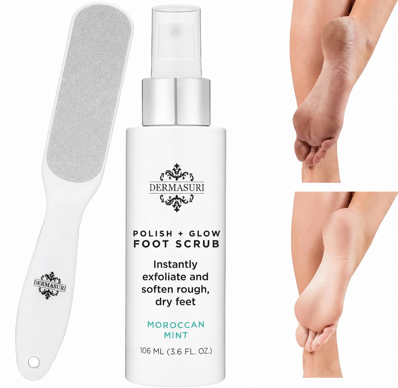 Dermasuri Callus Remover Foot Scrub Kit