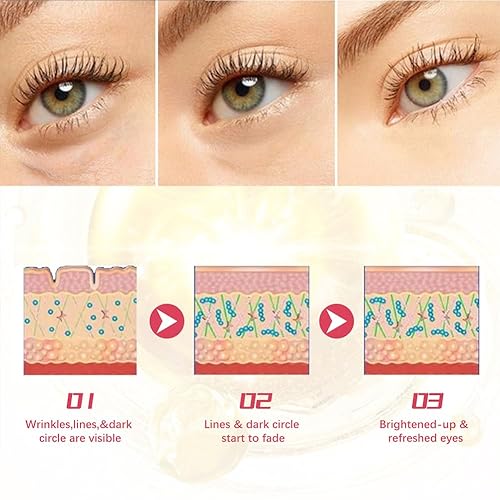 Miniatura 4 de Crema de ojos, crema de ojos con retinol para ojeras hinchazón, antiarrugas, antienvejecimiento crema de ojos, crema de ojos suavizante, cuidado de