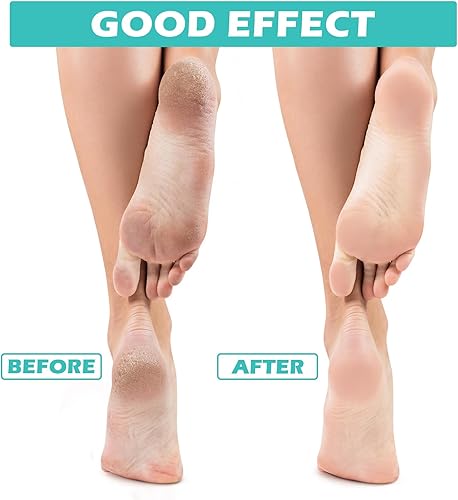 Miniatura 4 de Tarpop 3 pares de calcetines de aloe hidratantes para pies secos y agrietados, calcetines con infusión de gel para dormir, calcetines peludos de