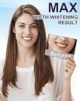 Vista 5 de MySmile Lápiz Blanqueador de Dientes 30+ Tratamientos Gel Blanqueador de Dientes Seguro para el Esmalte para Dientes Sensibles-Blanqueamiento Rápido