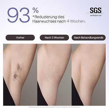 Ulike Air 3 IPL Hair Removal Device for Face and Body at Home Alternative to Laser Hair Removal with Sapphire Ice Cooling System for Painless Long-Lasting Results Provence Purple Pain-free skin-friendly sapphire ice cooling system home whole body 93% hair reduction 4 weeks