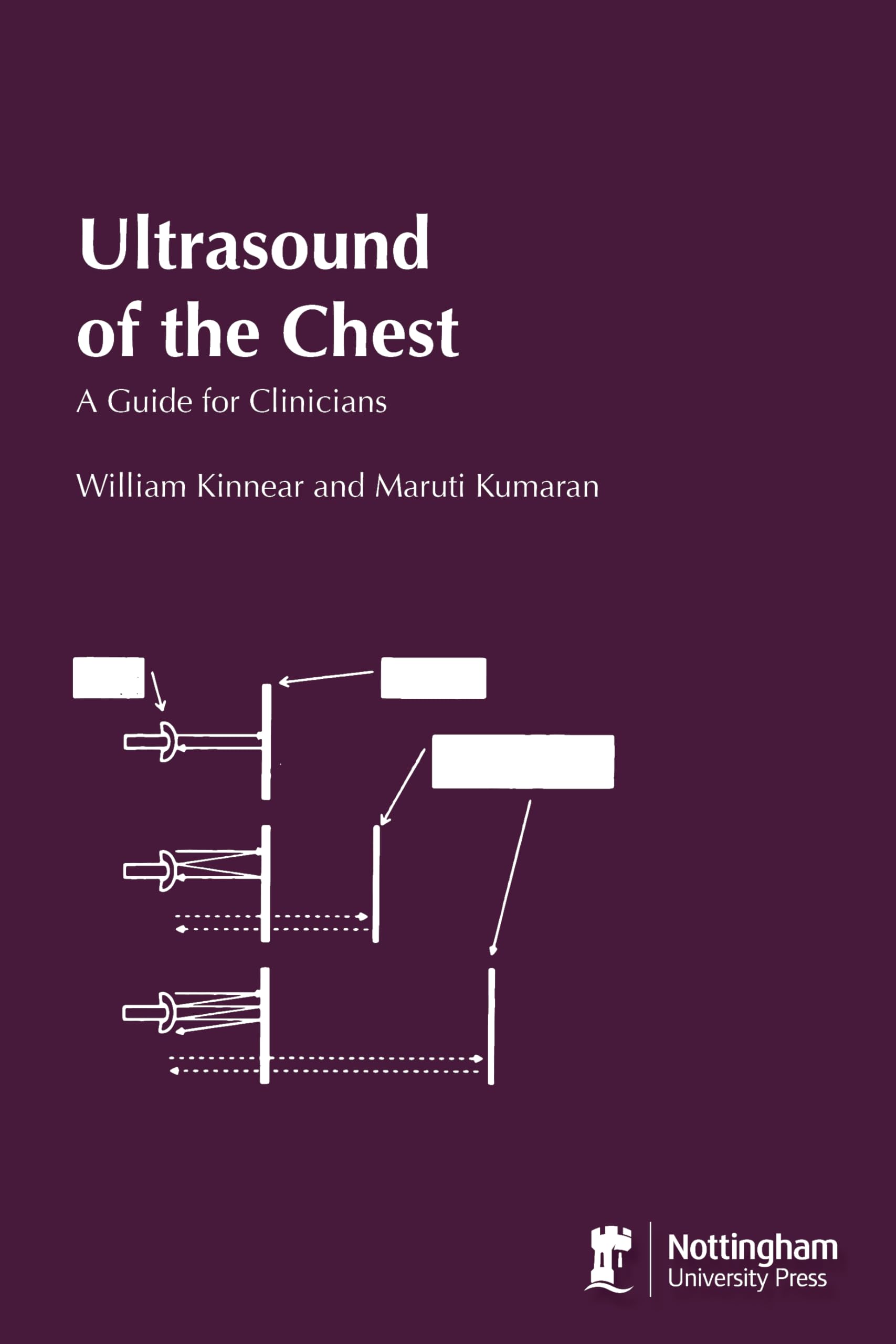 Ultrasound of the Chest: A Guide for Clinicians